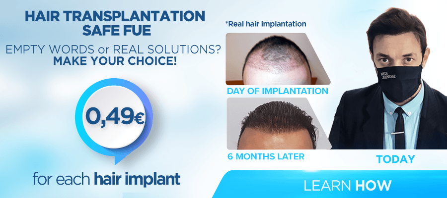 Hair Transplantation SAFE FUE 0,49€ / HAIR IMPLANT